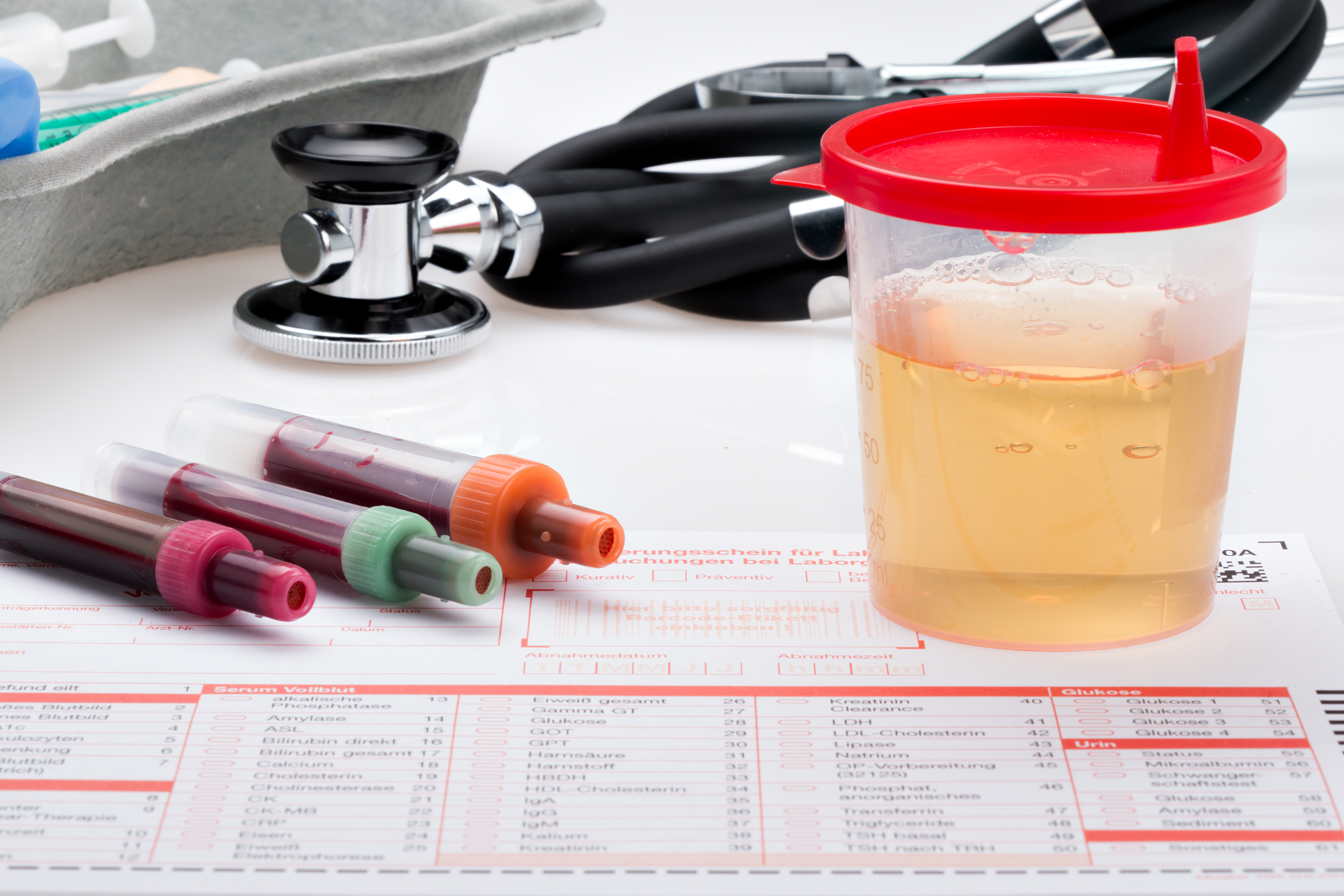 Urine sample for people with hematuria life insurance application